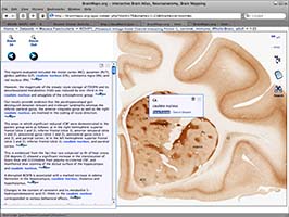 Brain Maps AJAX viewer